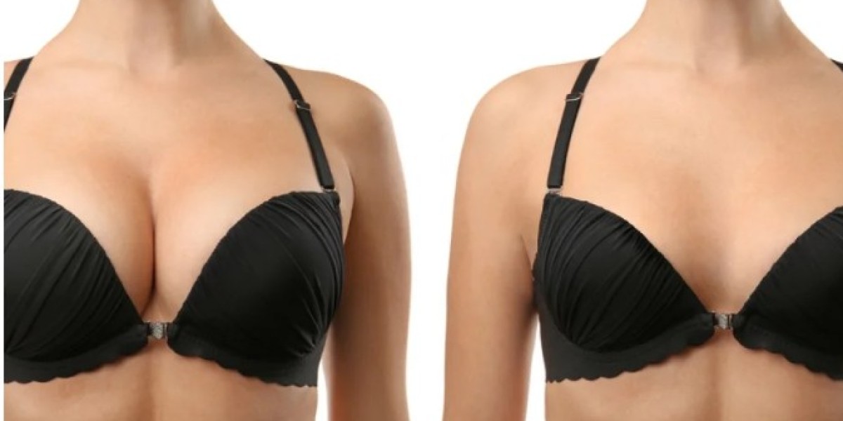 Comprehensive Breast Lump Treatment in Pune