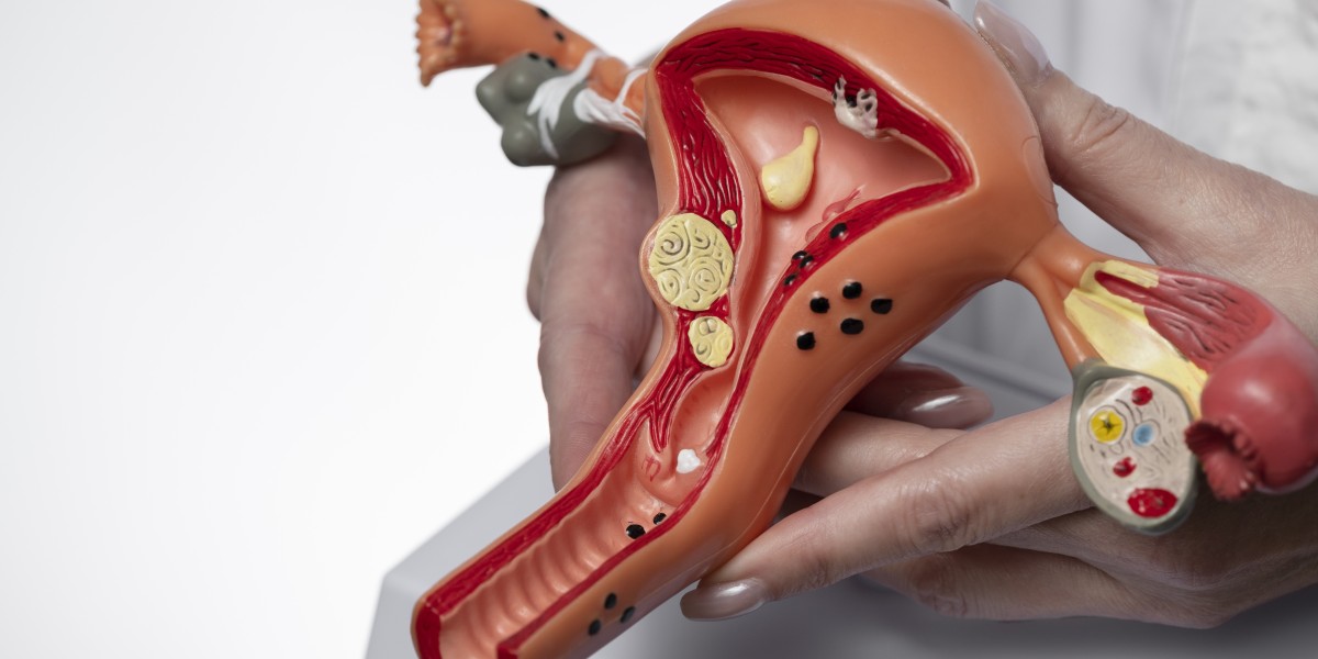 Hysterectomy in Gurgaon: Types, Recovery & Top