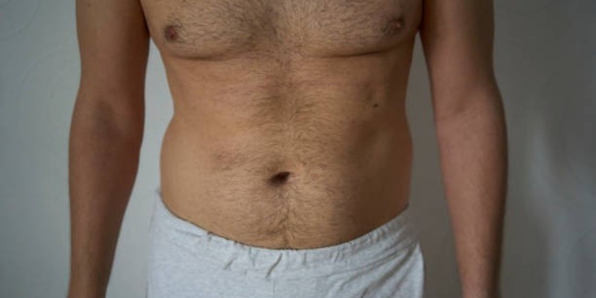 Gynecomastia Surgery in Riyadh: Achieve a Sculp