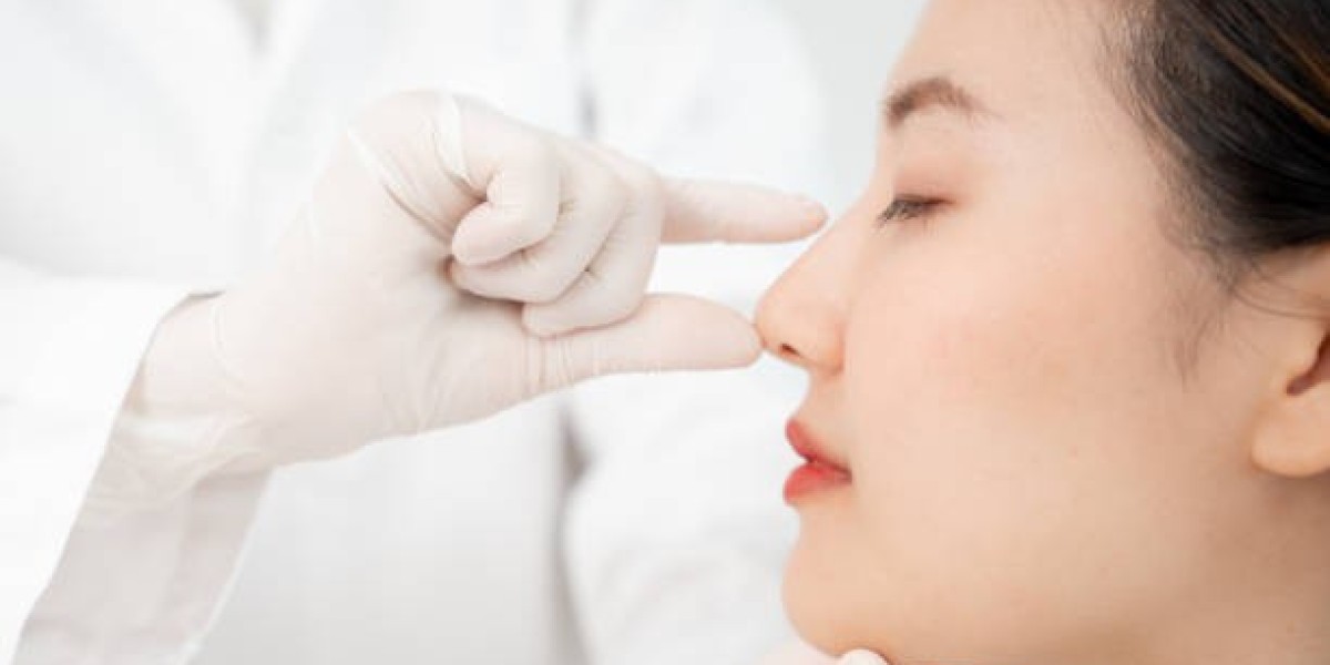 Rhinoplasty in Riyadh for a Balanced Nose Struc