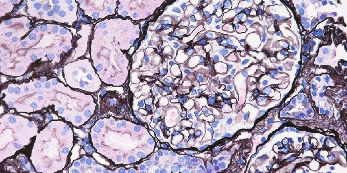 NephCure Inc: Minimal Change Disease Causes