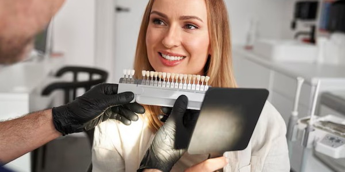 Understanding Dental Veneers and Their Costs