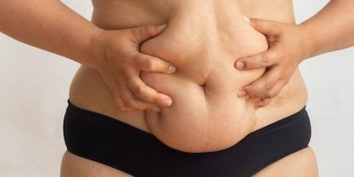 Your Journey Begins with Obesity Surgery in Riy
