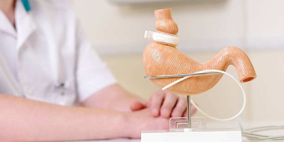 Your Guide to Bariatric Surgery Riyadh Options