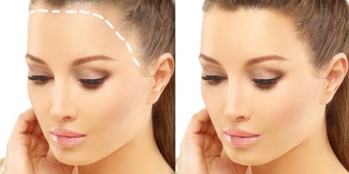 عيادات زراعة الشعر في الرياض: تقييم ومراجعات