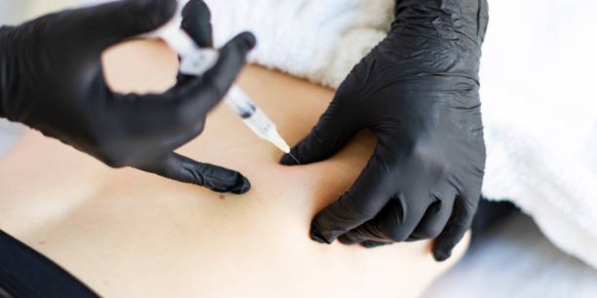 Sculpt Your Body with Professional Fillers in R