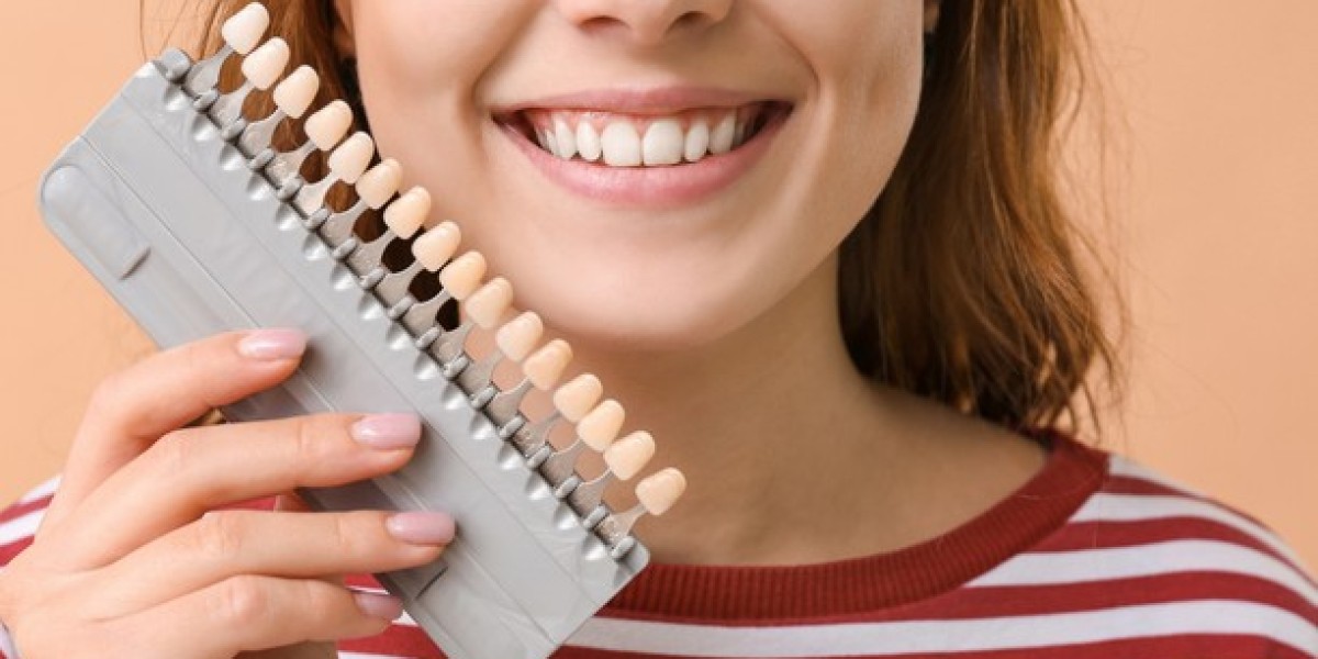 Transform Your Smile with Teeth Veneers