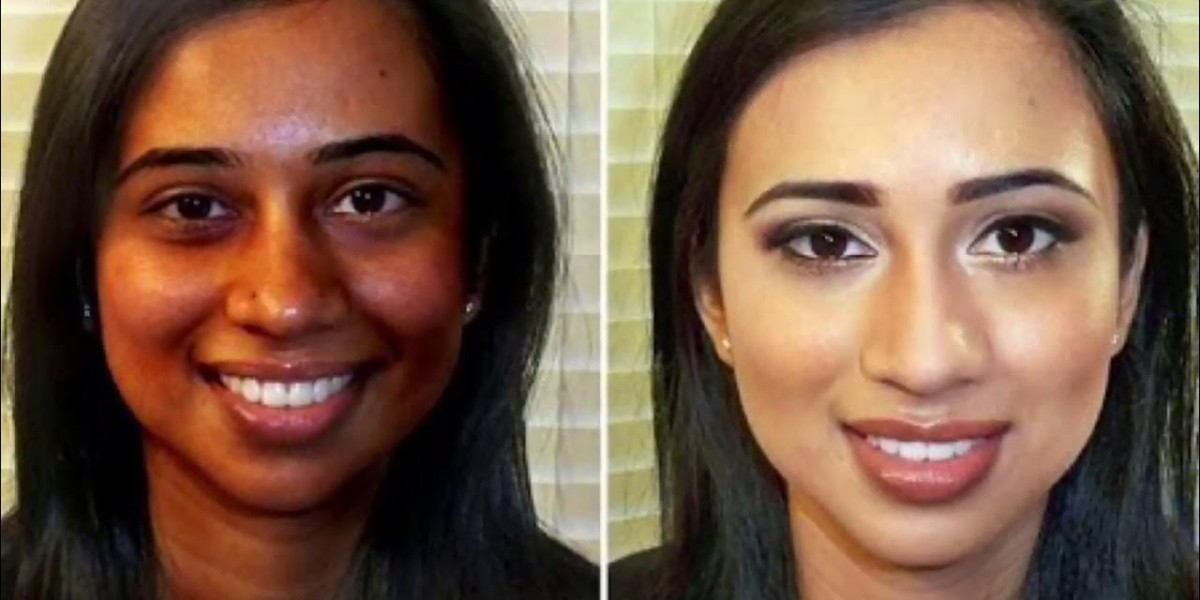 احصلي على نتائج طبيعية مع عيادة تجميل موثوقة با