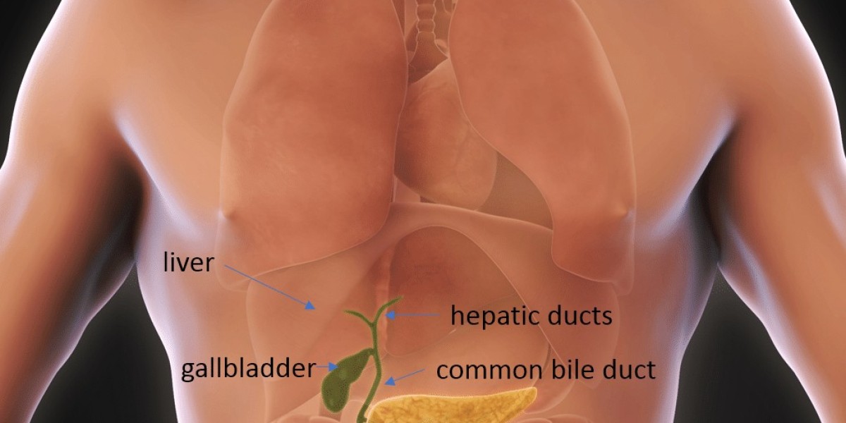 Gallbladder Surgery in Riyadh: All You Need to