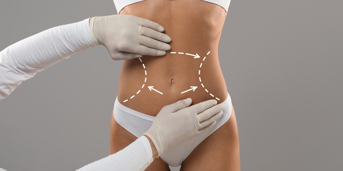 When Can You Return to Work After Liposuction?