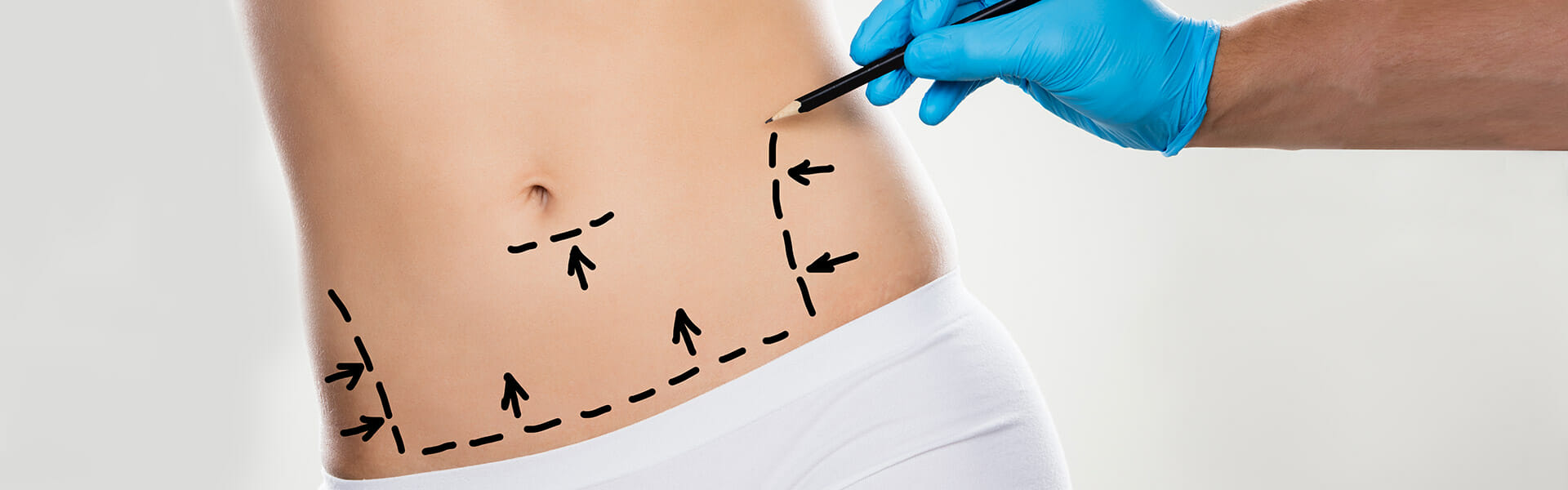 Plastic Surgery Procedures in San Francisco | Advanced Aesthetics