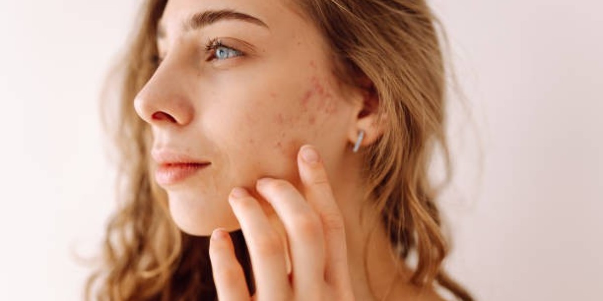 Dermatologist-Recommended Sunscreens for Every