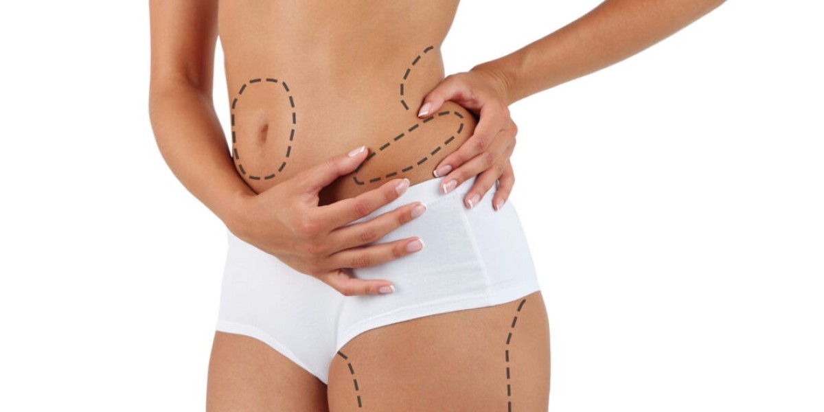 Can Teenagers Get Liposuction in Islamabad?
