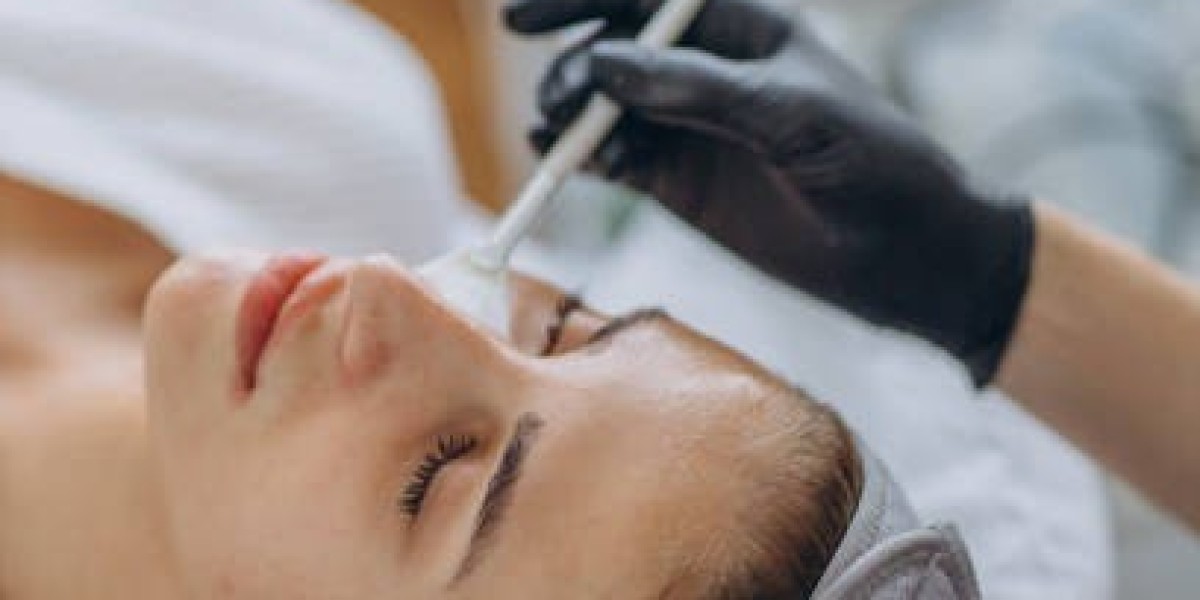 Chemical Peels in Dubai: Revitalize Your Look