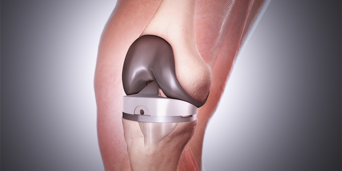 Total Knee Replacement Market 2031: Overview
