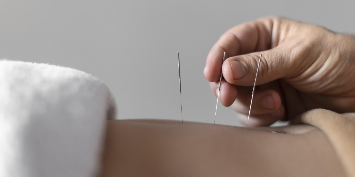 Experience Holistic Healing with Acupuncture in