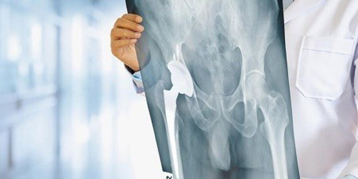 7 Knee Pain Myths Busted by Nagpur’s Best Knee