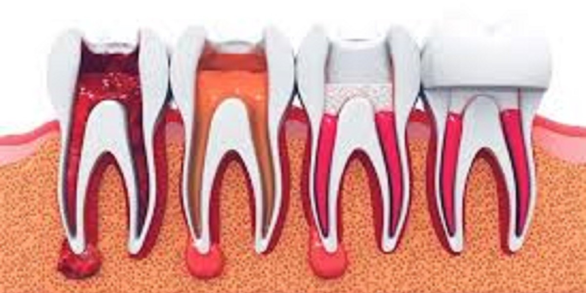 Orthodontist in adliya 