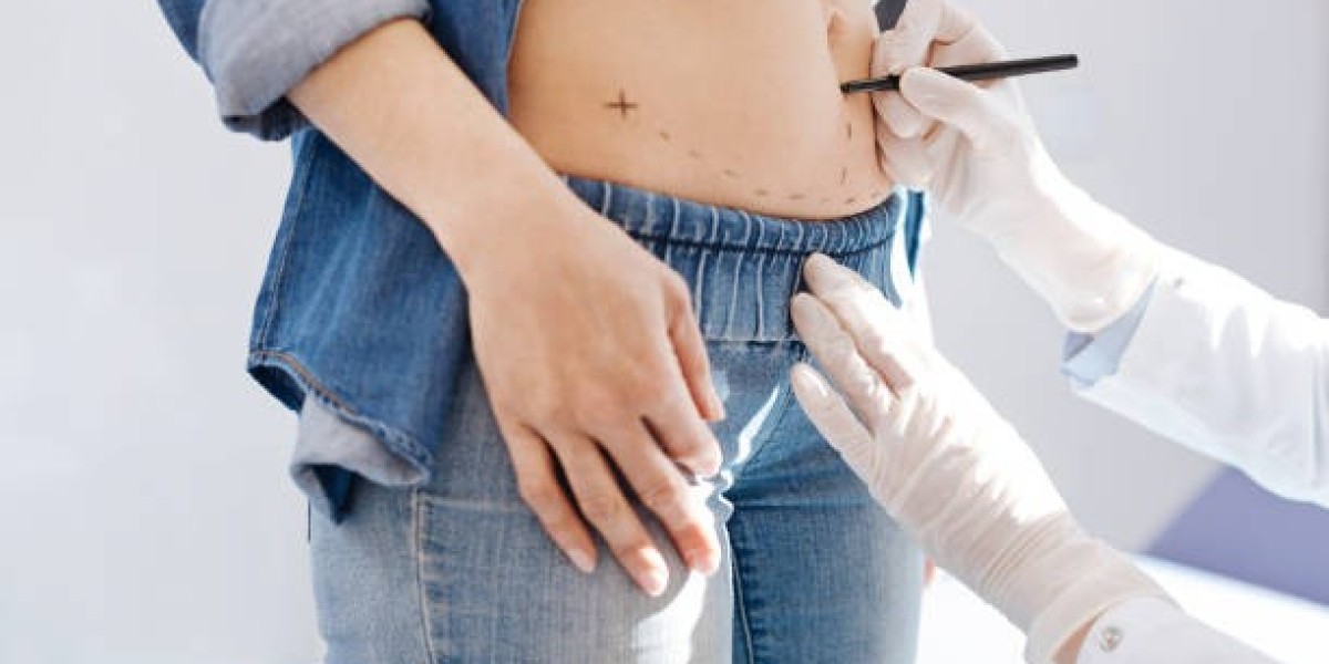 Tummy Tuck in Dubai: Your Path to a New Shape