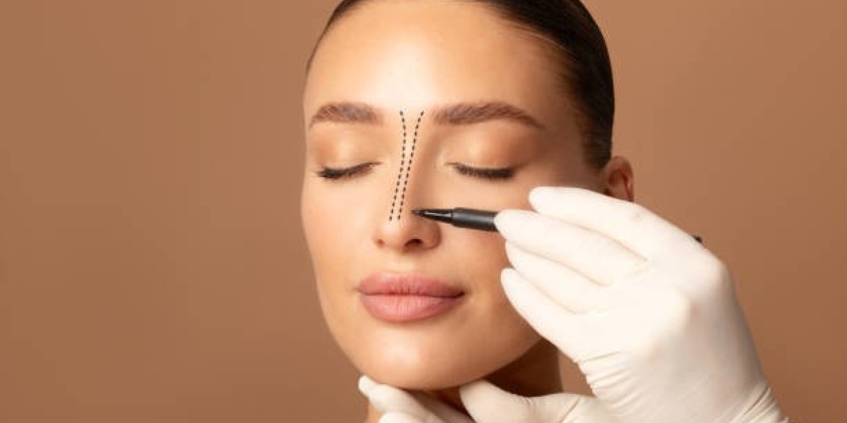 Rhinoplasty Surgery: Real Patient Experiences