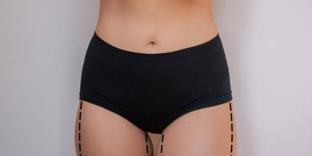 Redefine Your Look with Thigh Lift in Riyadh