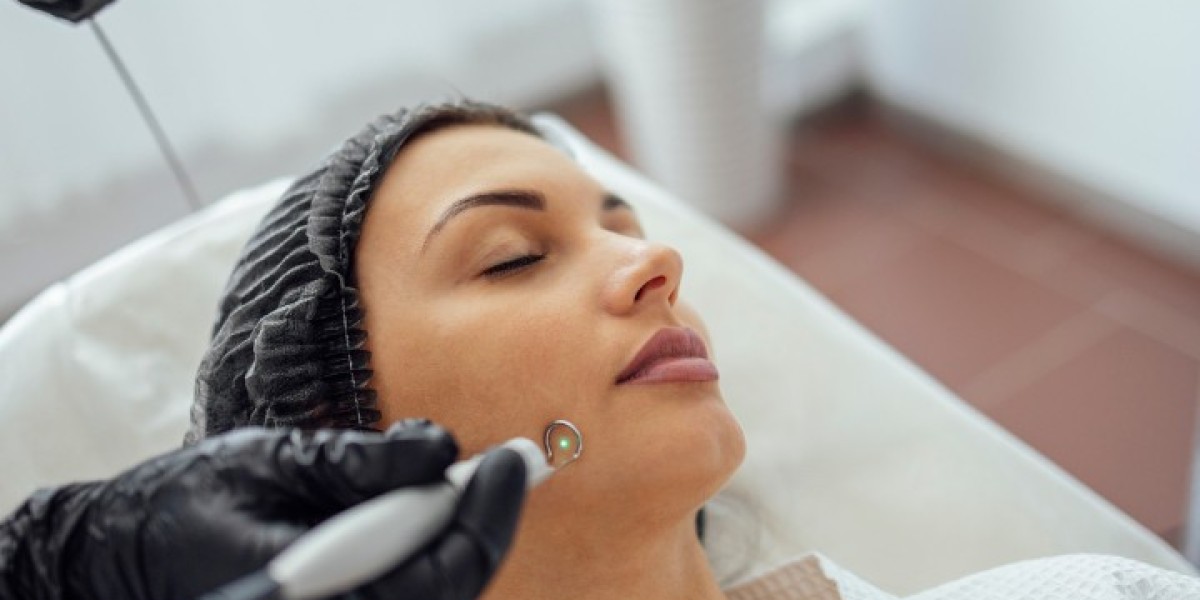 GFC vs PRP Hair Treatment in Hyderabad