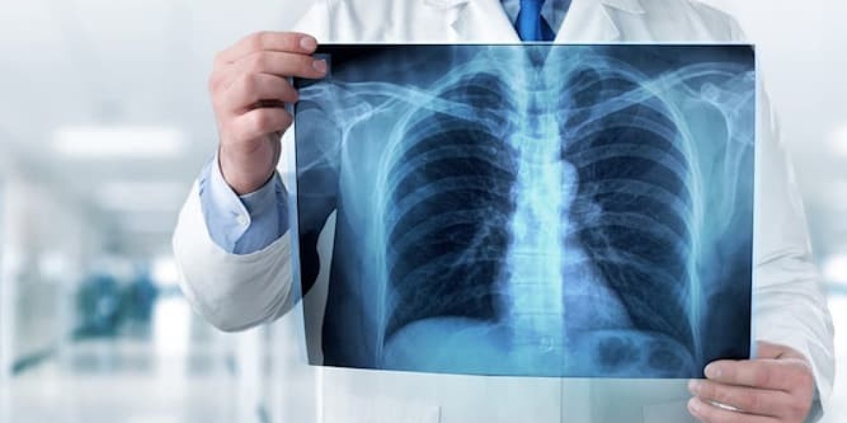 Urgent X-Ray League City: Fast & Accurate Imagi