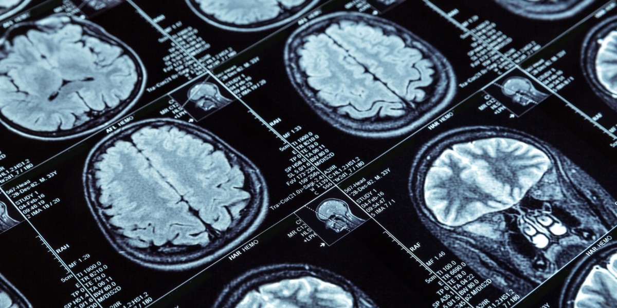 Comprehensive Market Study of 4K Medical Imagin