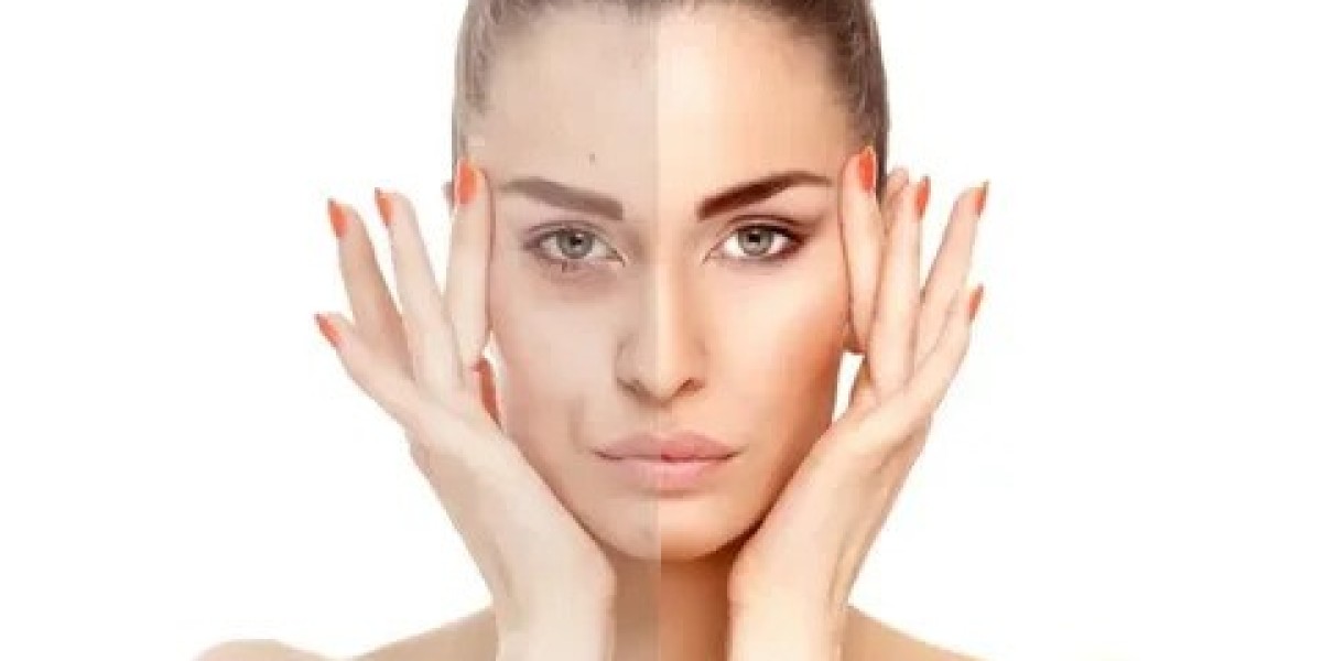 Advanced Skin Tightening in Tysons Corner