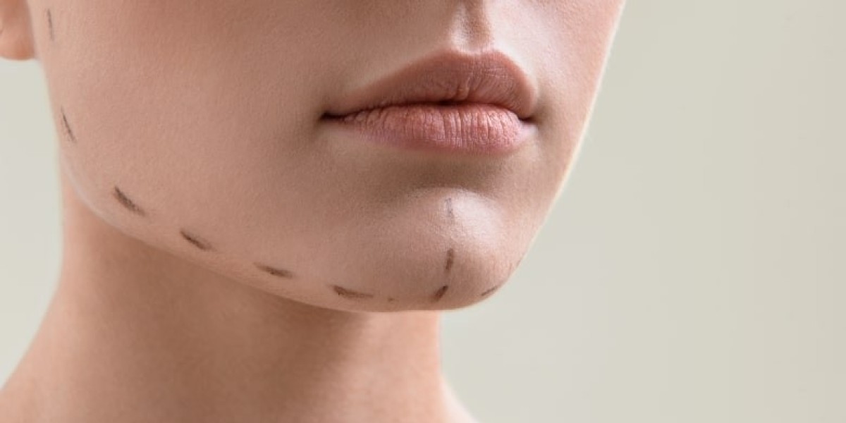 How Facial Sculpting Can Help Reduce Wrinkles a