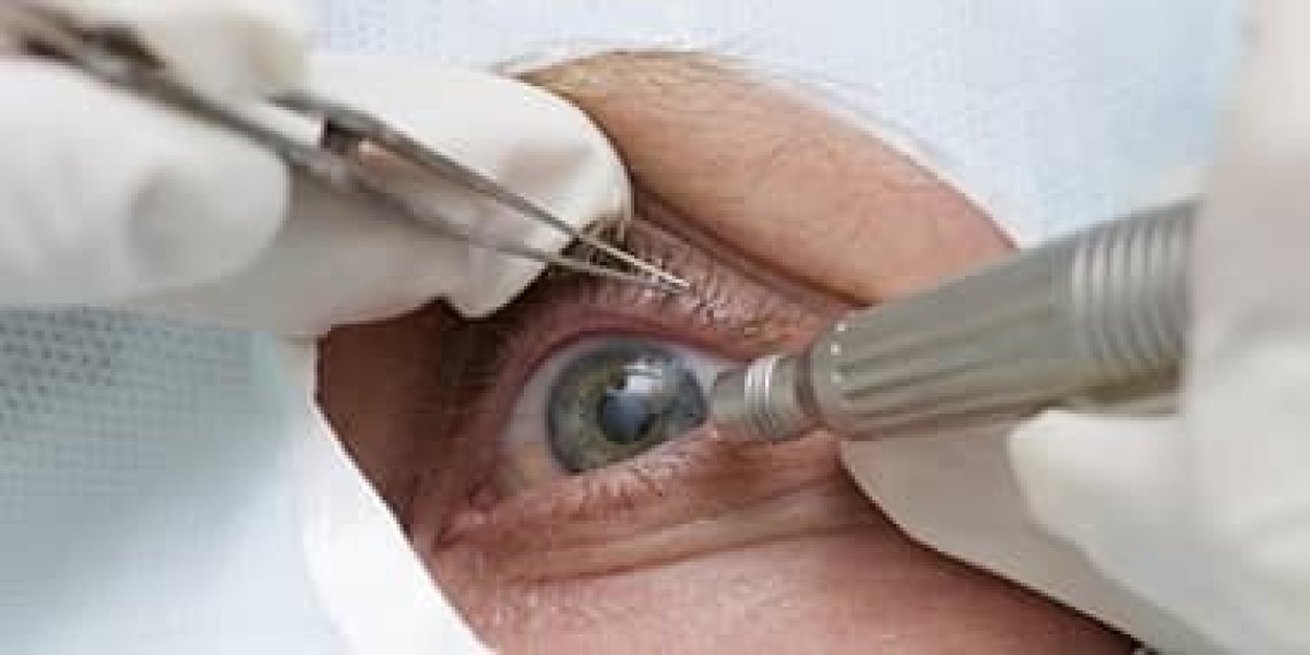 Refractive Lens Surgery in Punjab: A Clear Solu