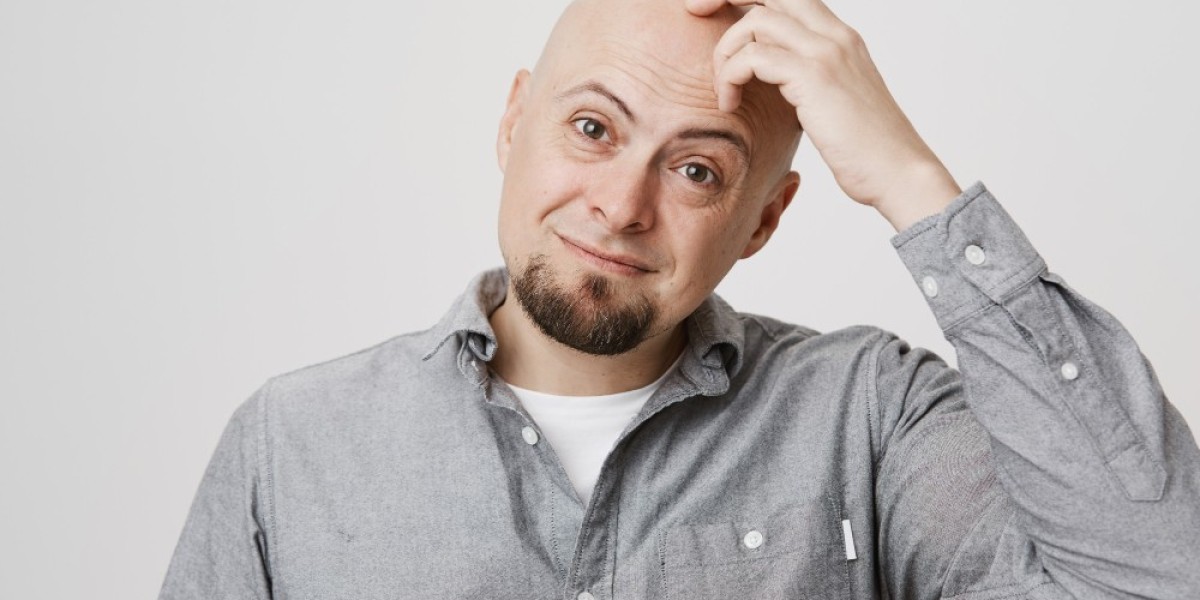 What Causes Alopecia Areata? Exploring Triggers