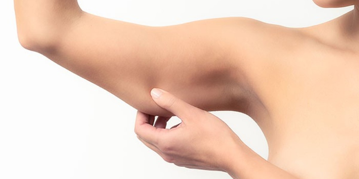 The Best Time to Get an Arm Lift: Age, Season,