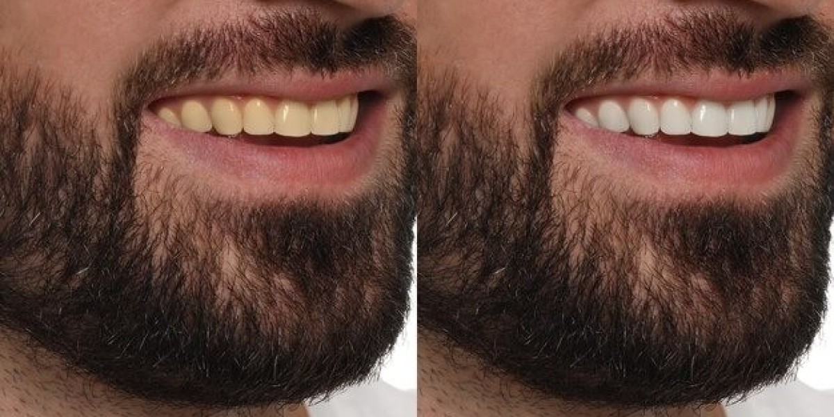 Cosmetic Dentistry Solutions in Scarsdale, NY