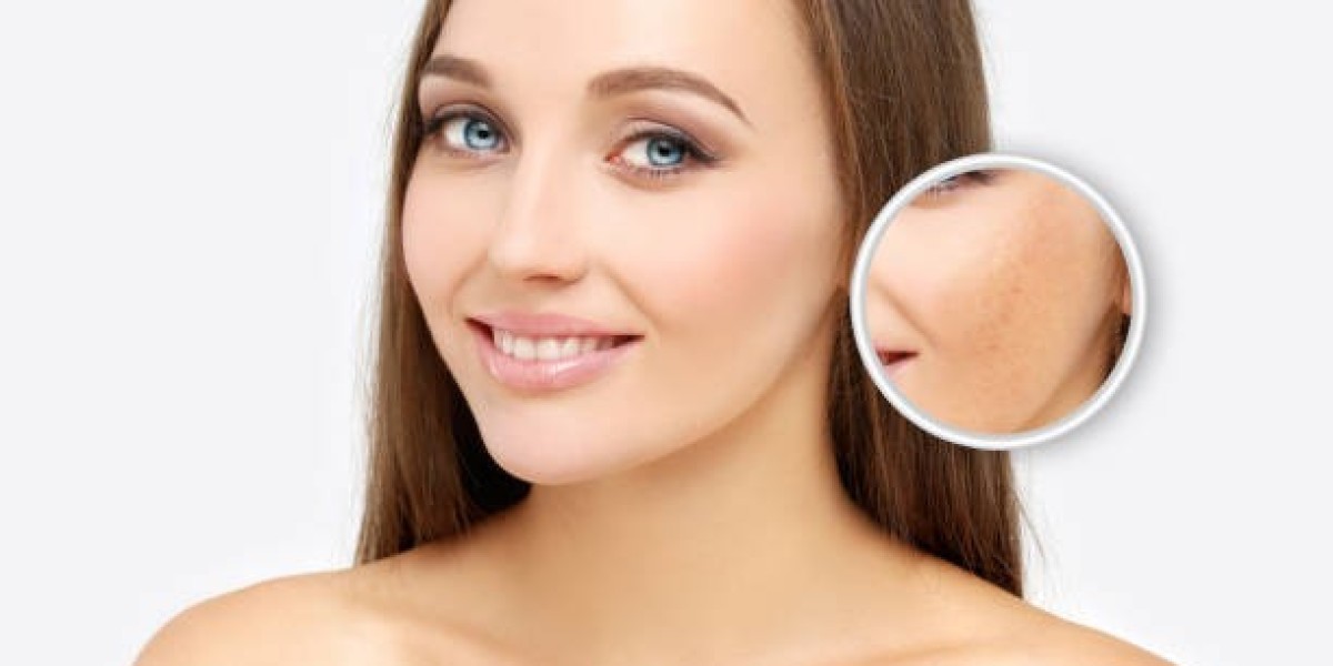 Chemical Peels in Dubai: A Fresh Face Guide
