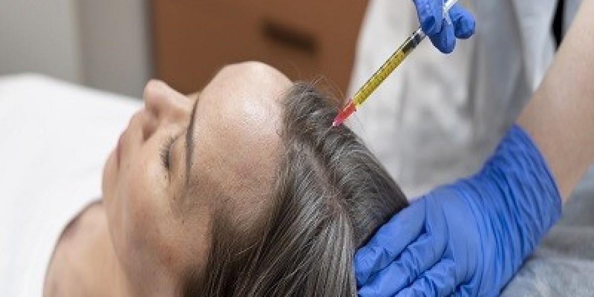 How long do PRP results last?