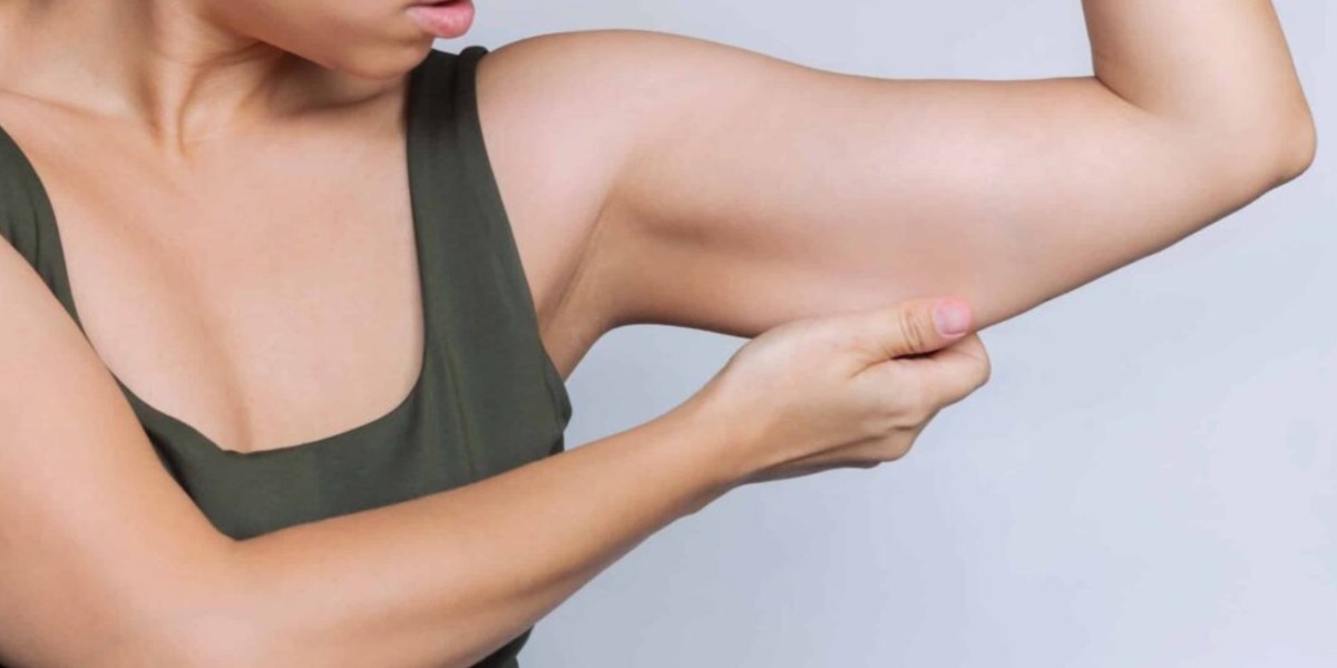 How Long Do Arm Lift Results Last?