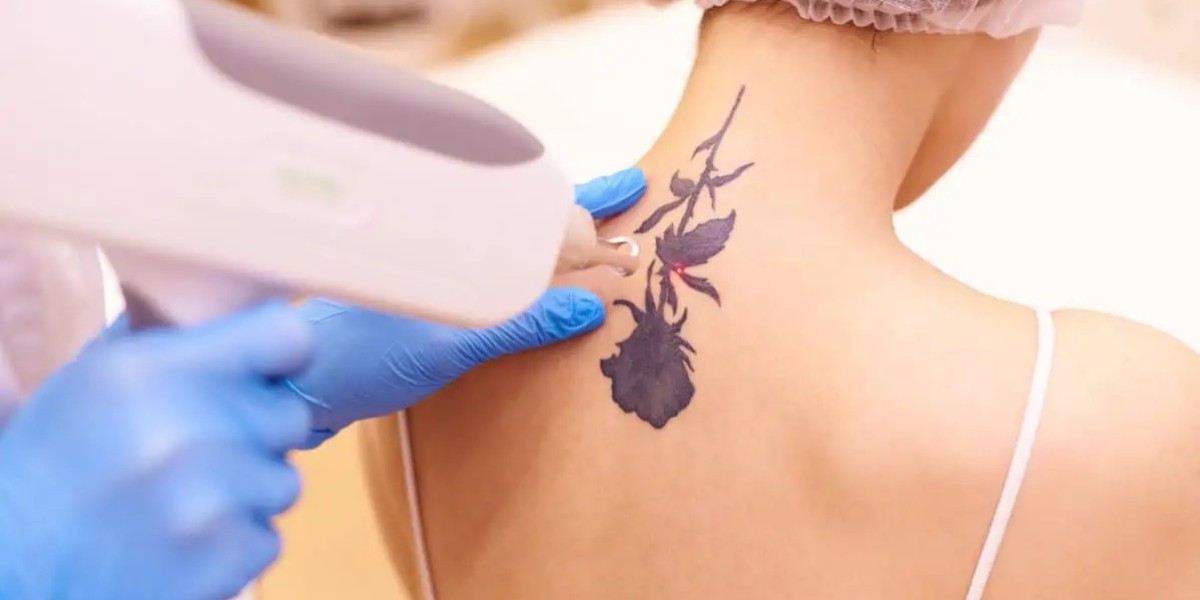 Understanding the Healing Process After PicoSur