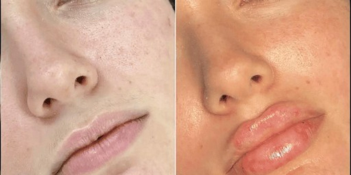Meet Dubai's Best Plastic Surgeons For Fillers