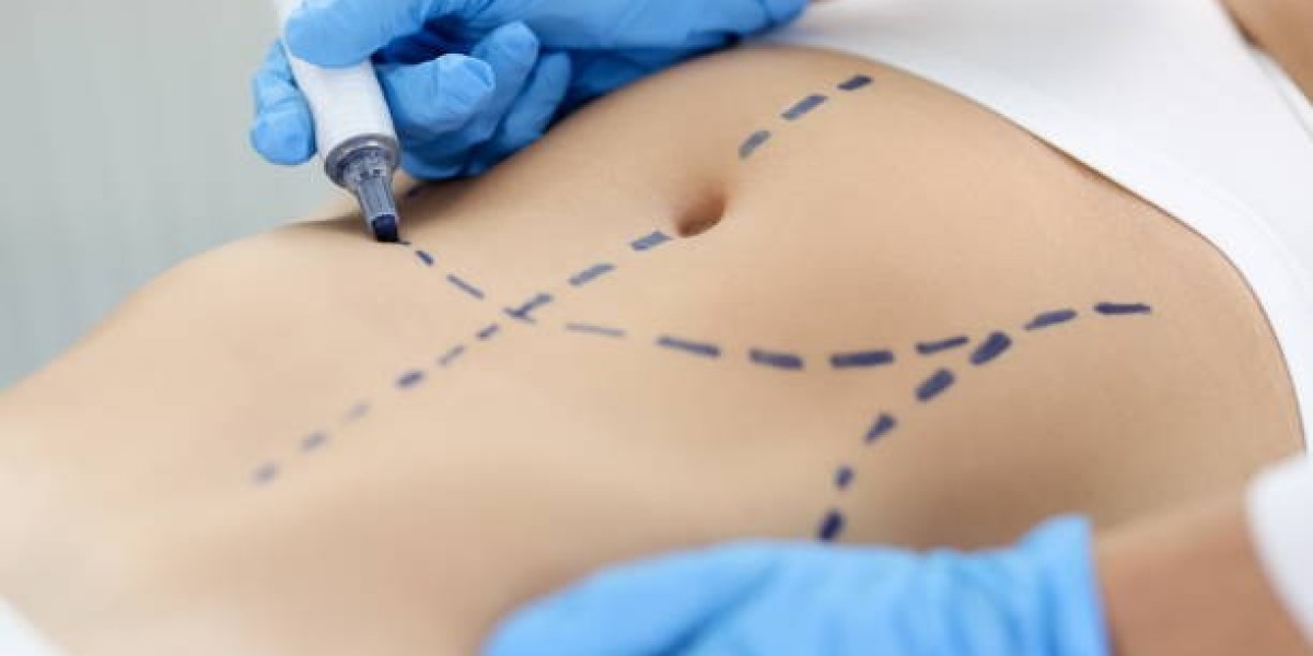 Tummy Tuck in Dubai: Begin Your Journey